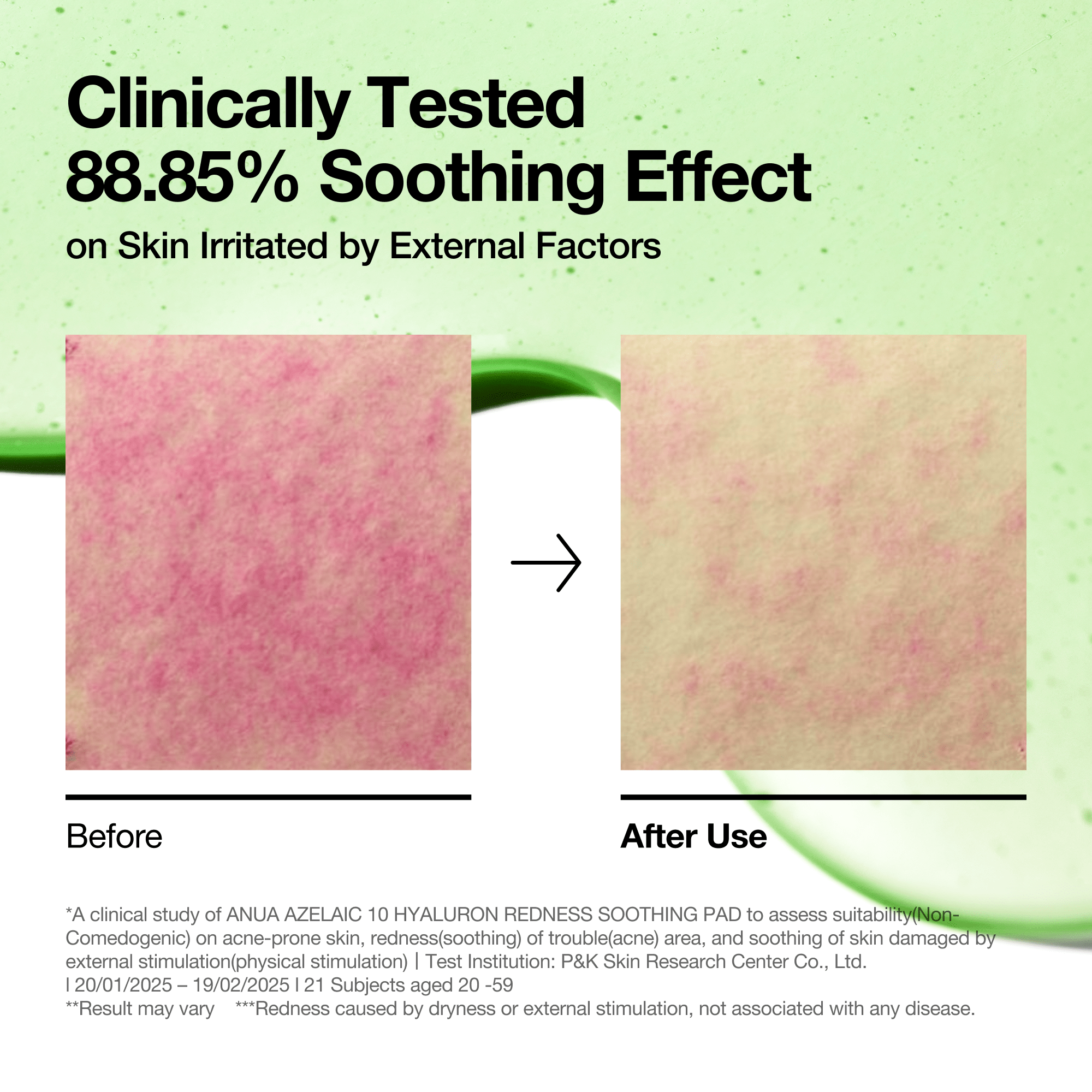 Anua 10% Azelaic Acid Serum With Hyaluronic Acid